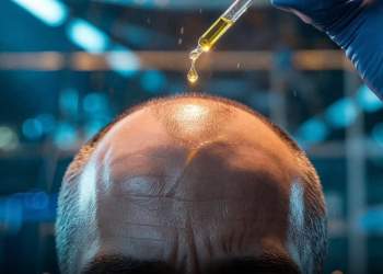 Flokët rikthehen natyralisht: Zbulimi revolucionar i Universitetit të Tajvanit