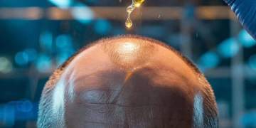 Flokët rikthehen natyralisht: Zbulimi revolucionar i Universitetit të Tajvanit