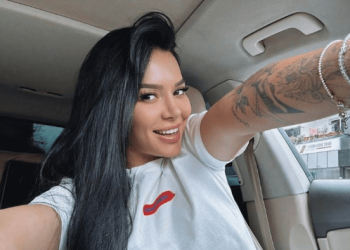 “Ky është operimi i katërt”/ Efi Dhedhes flet për herë të parë pas ndërhyrjes: Nuk ishte estetike