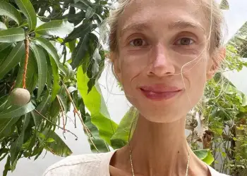 Studentja 27-vjeçare që vdiq nga uria në Bali: Ajo hëngri vetëm fruta