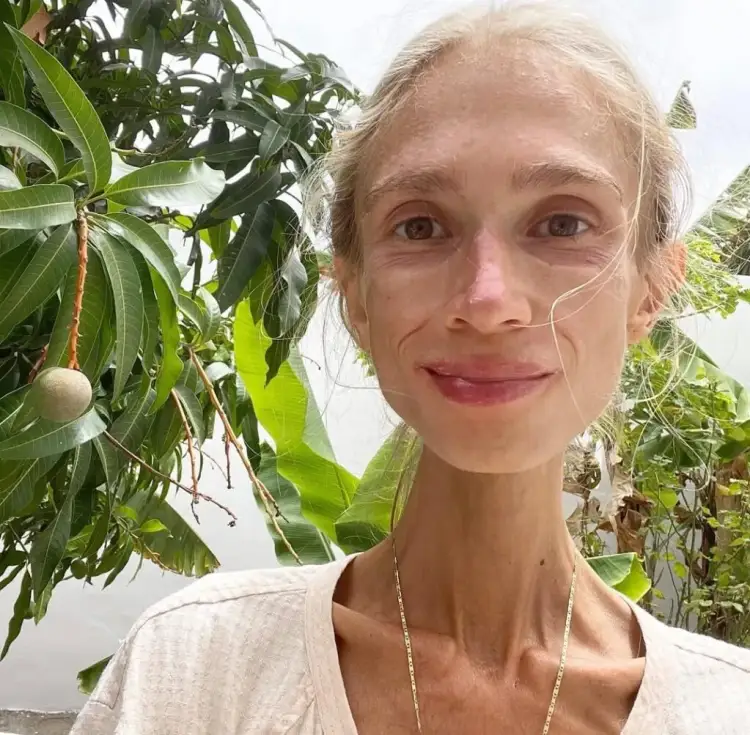 Studentja 27-vjeçare që vdiq nga uria në Bali: Ajo hëngri vetëm fruta