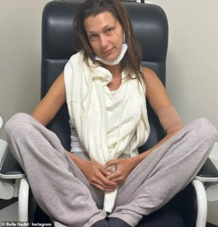 Bella Hadid flet hapur për ankthin dhe sëmundjen Lyme: Ka një ndjenjë turpi