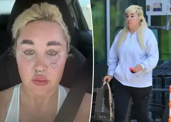 Amanda Bynes tregon transformimin e saj me Ozempic: Kam humbur nëntë kilogramë dhe dua të vazhdoj