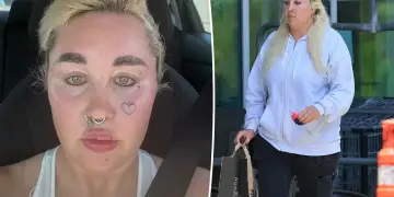 Amanda Bynes tregon transformimin e saj me Ozempic: Kam humbur nëntë kilogramë dhe dua të vazhdoj