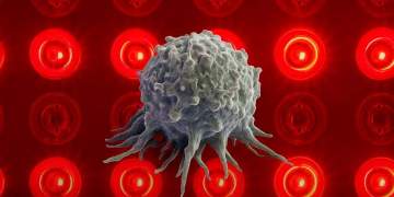 92 për qind e qelizave të kancerit të lëkurës shkatërrohen me terapi të saktë me dritë, ndërsa indi i shëndetshëm nuk preket fare