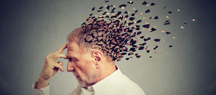 Shenjë paralajmëruese e re për Alzheimerin: Atrofia Kortikale Posteriore në qendër të studimit