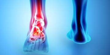 Kujdesi për tendinat: si të parandaloni dëmtimet dhe dhimbjet