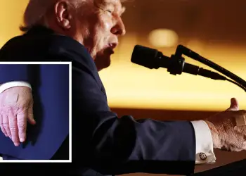 Ngjitësi në duart e Trump nxis thashethemet për shëndetin e tij