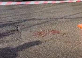 E rëndë në Durrës/ Babai qëllon me thikë vajzën e tij, plagos dhe një person i cili ndërhyri për ta ndihmuar