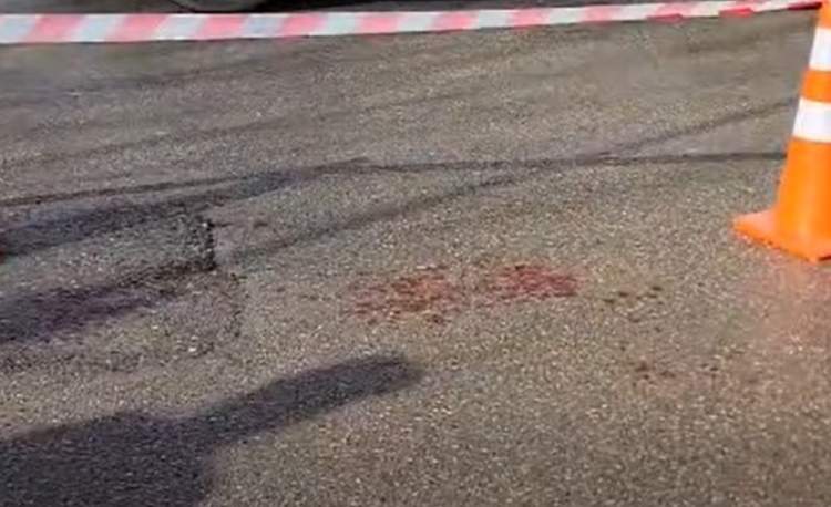 E rëndë në Durrës/ Babai qëllon me thikë vajzën e tij, plagos dhe një person i cili ndërhyri për ta ndihmuar