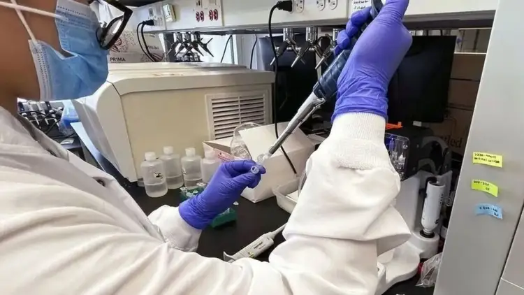 Sëmundja e Crohn-it: Si një analizë e thjeshtë gjaku mund ta parashikojë atë vite para se të shfaqen simptomat