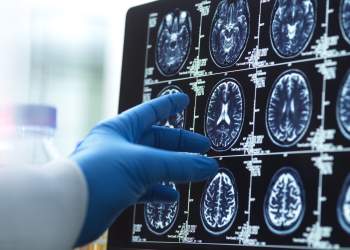 Këto janë moshat në jetën tonë kur truri ynë ndryshon