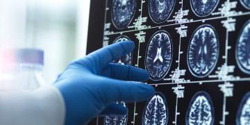 Këto janë moshat në jetën tonë kur truri ynë ndryshon