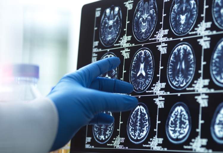 Këto janë moshat në jetën tonë kur truri ynë ndryshon