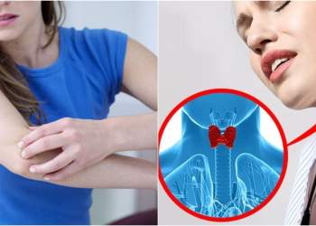 Çfarë tregojnë duart për shëndetin e tiroides? Shenjat paralajmëruese