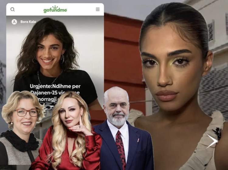 Mes jetës dhe vdekjes, modelja Dajana Kalo me hemorragji cerebrale, QSUT i rrezikon jetën