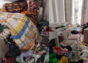 Ngjarja në Durrës/ Fëmijët 3 ditë pa ngrënë, të infektuar me zgjebe, nënës do i hiqet kujdestaria