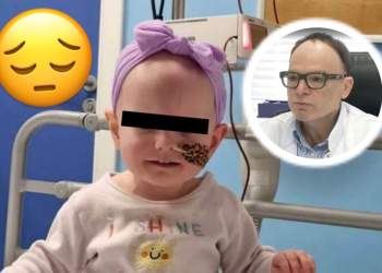 Pse ndodhin Tumori dhe Hemorragjia Cerebrale tek fëmijët e vegjël? Shpjegon neurokirurgu