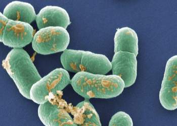 Tragjedi në SHBA: Foshnja humb jetën nga listeria, alarm për qumështin e papërpunuar