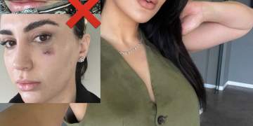 “Më përdorën si kavie”/ Gazetarja me akuza të forta për neglizhencë mjekësore ndaj klinikës së shfaqur në podcastin e Ramës