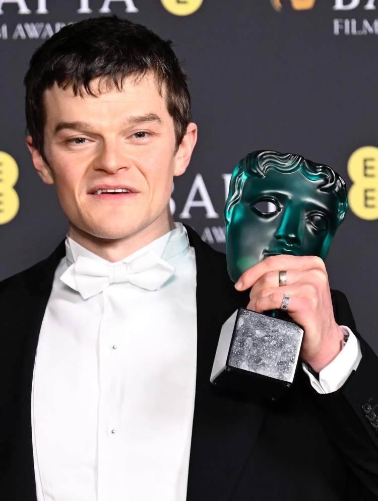 Robert Aramayo fiton BAFTA 2026 për Aktorin më të Mirë, lë pas DiCaprion dhe Chalamet