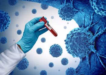 Studimi: 40% e rasteve të reja të kancerit në botë mund të parandalohen!