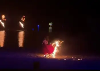 Performanca kthehet në tmerr! Flakët përpijnë fustanin e balerinës