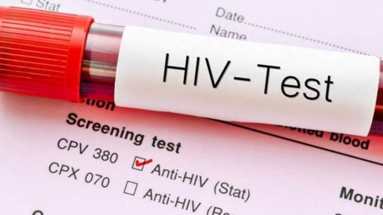 HIV rikthehet në nivele alarmante në vend: Të rinjtë më të prekur, një në tre raste zbulohet vonë