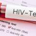 HIV rikthehet në nivele alarmante në vend: Të rinjtë më të prekur, një në tre raste zbulohet vonë
