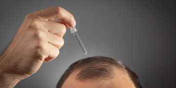 S’ka më tullaci? Serumi i ri bimor nga Kina lidhet me rritjen e flokëve brenda disa javësh