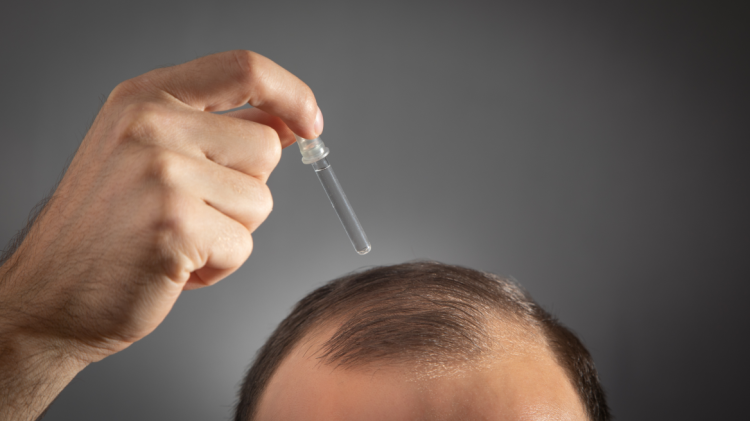 S’ka më tullaci? Serumi i ri bimor nga Kina lidhet me rritjen e flokëve brenda disa javësh