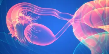 Cili është emri i ri për PCOS? Ja çfarë duhet të dinë pacientët
