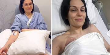 Jessie J zbulon se ka mposhtur kancerin: “Qava me orë të tëra”