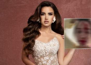 Miss Venezuela 2025 sulmohet në Kanë, stilisti i saj arrestohet nga policia