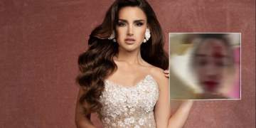 Miss Venezuela 2025 sulmohet në Kanë, stilisti i saj arrestohet nga policia