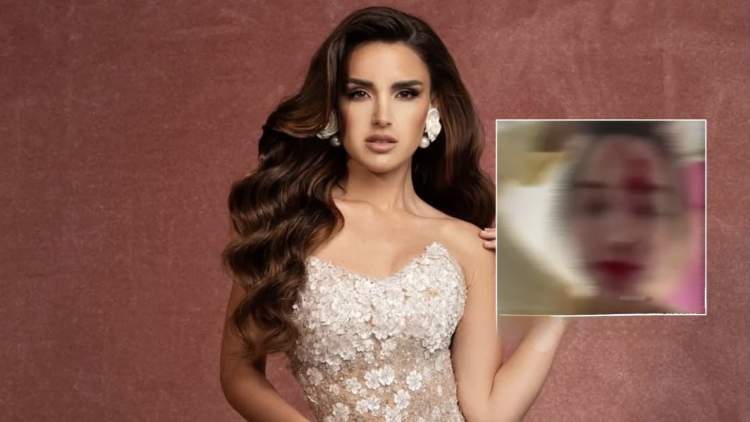 Miss Venezuela 2025 sulmohet në Kanë, stilisti i saj arrestohet nga policia