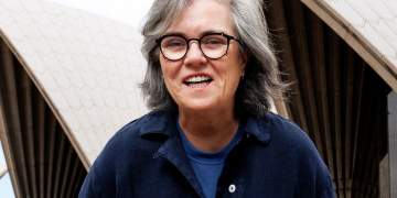 Rosie O’Donnell pranon facelift-in: “Kushtoi më shumë se makina ime”