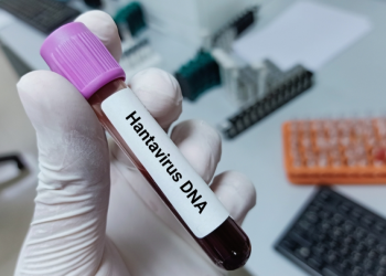 Alarm në Spanjë: Pasagjeri në MV Hondius që ishte në karantinë rezulton pozitiv për koronavirus