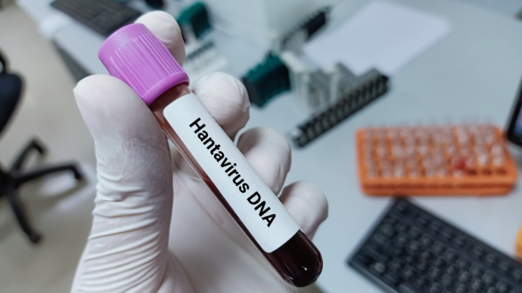 Alarm në Spanjë: Pasagjeri në MV Hondius që ishte në karantinë rezulton pozitiv për koronavirus