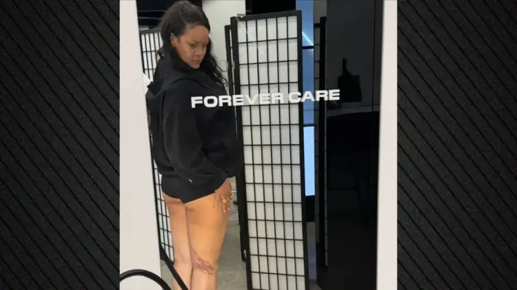 Nga letra në lëkurë! Rihanna kthen vizatimet e fëmijëve në tatuazh